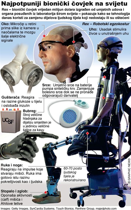 Upoznajte Rexa, prvog umjetnog čovjeka Upoznajte Rexa, prvog umjetnog čovjeka