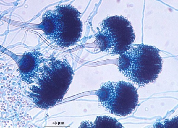 Aspergillus fumigatus Aspergillus fumigatus