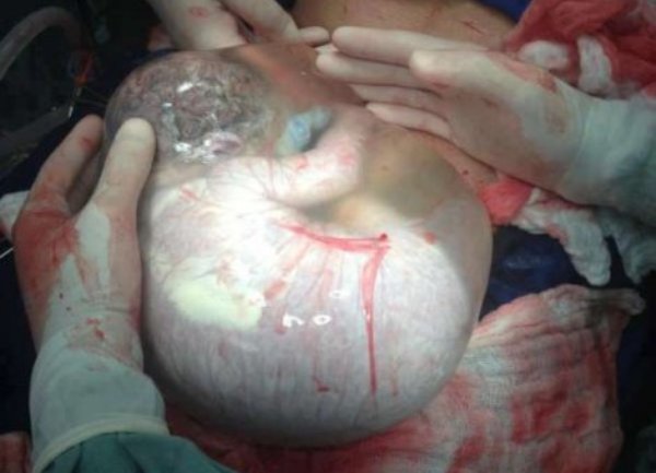 beba u posteljici nova