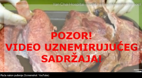 pluća nakon 60 ispu&scaron;enih cigareta