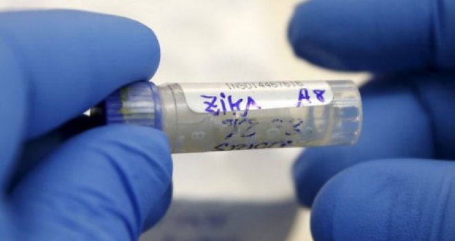 Zabilježen prvi slučaj prenosa Zika virusa seksualnim putem