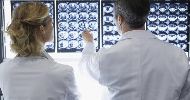 Naučnici otkrili iznenađujuću vezu između Alzheimera i navike koju mnogi prakticiraju