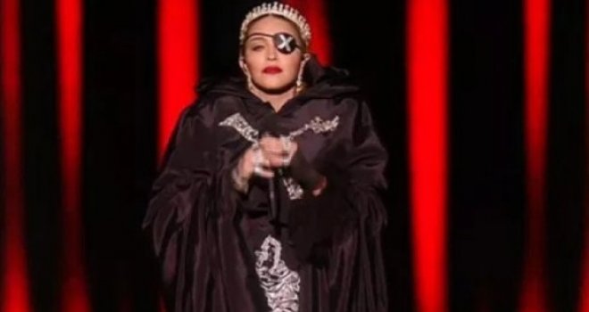 Madonna objavila novi selfie: 'Pogledajte kako sam slatka nakon što mi je splasnula oteklina od operacije'