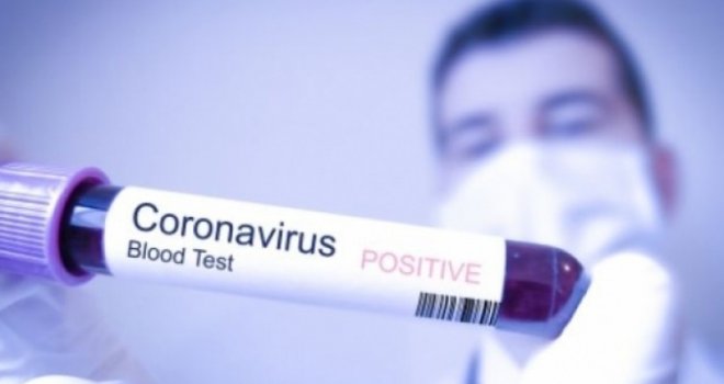 Potvrđen koronavirus u Hrvatskoj! Ovo su prve informacije o zaraženom...