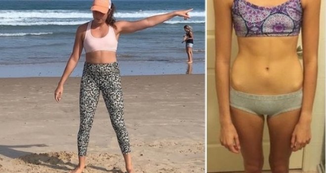 Instagram ih je skoro odveo u smrt: ‘Plačem i vrištim dok mi tata otvara čeljust, a mama me hrani na silu‘