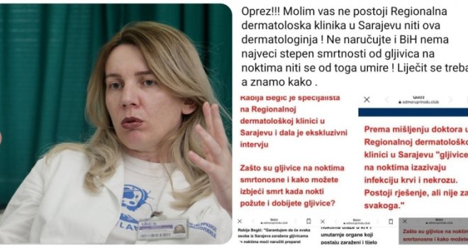 Ne nasjedajte! Ne postoji dermatologinja Rabija Begić, ni Regionalna dermatološka klinika u Sarajevu! Od gljivica se ne umire!