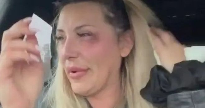 Pjevačica Monika Ivkić pretučena u Njemačkoj, grcala u suzama: 'Gazdarica kluba me prebila'